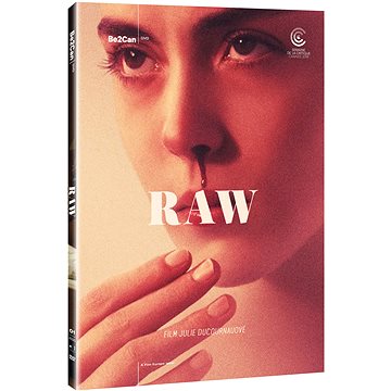Raw - DVD